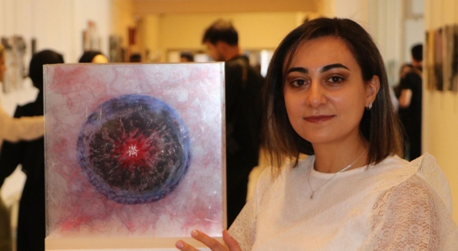 Migren ataklarını sanata dönüştürdü