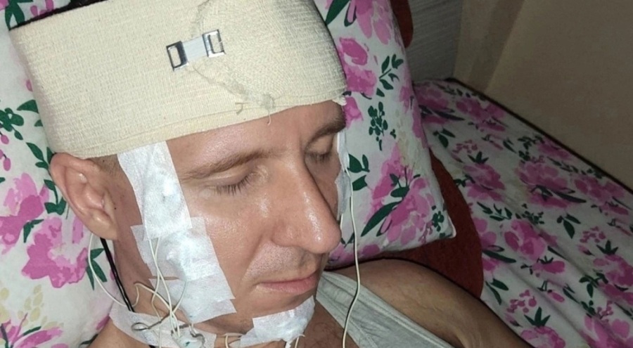 Şoke eden olay: Rüyalarını kontrol edebilmek için kafasını matkapla deldi!