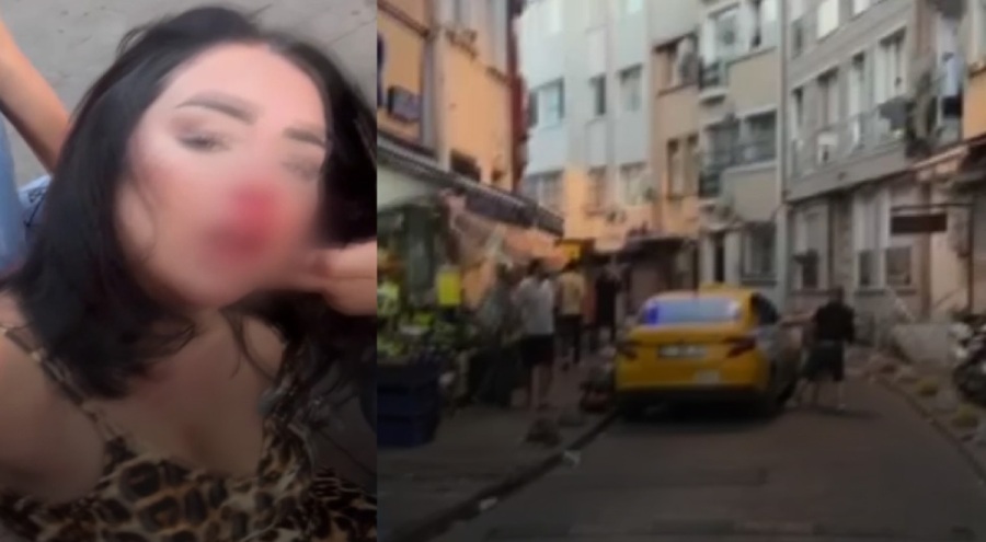 Kadın müşterisini feci şekilde darp eden taksici gözaltına alındı