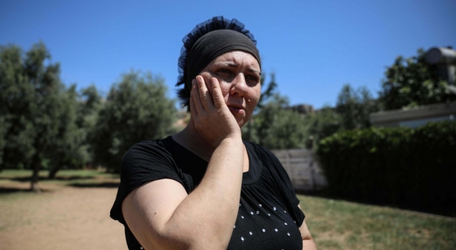 Delirten hastalık hayatını altüst etti: Yüzümü koparıp atmak istiyorum