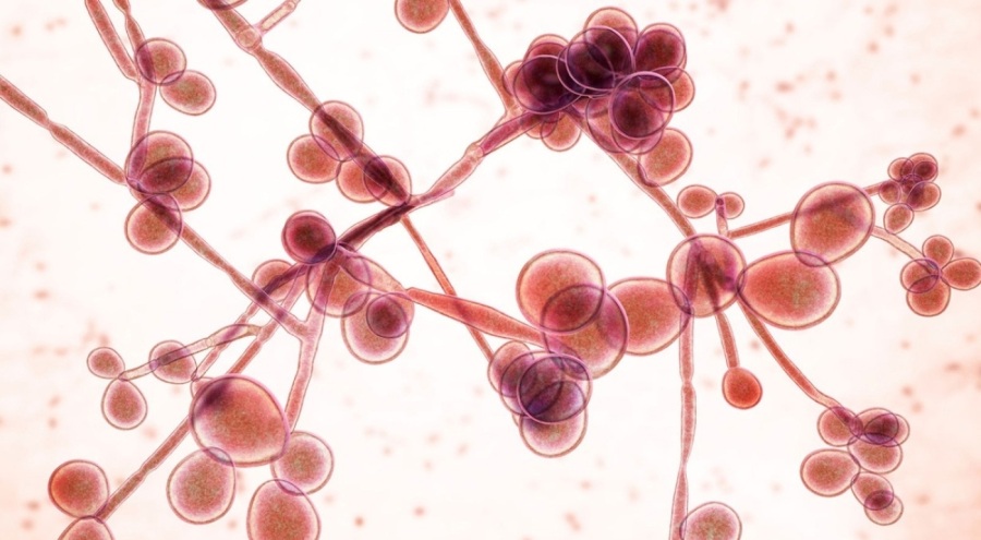 Salgın hastalık ilan edilen Marburg virüsüyle ilgili uyarı geldi!