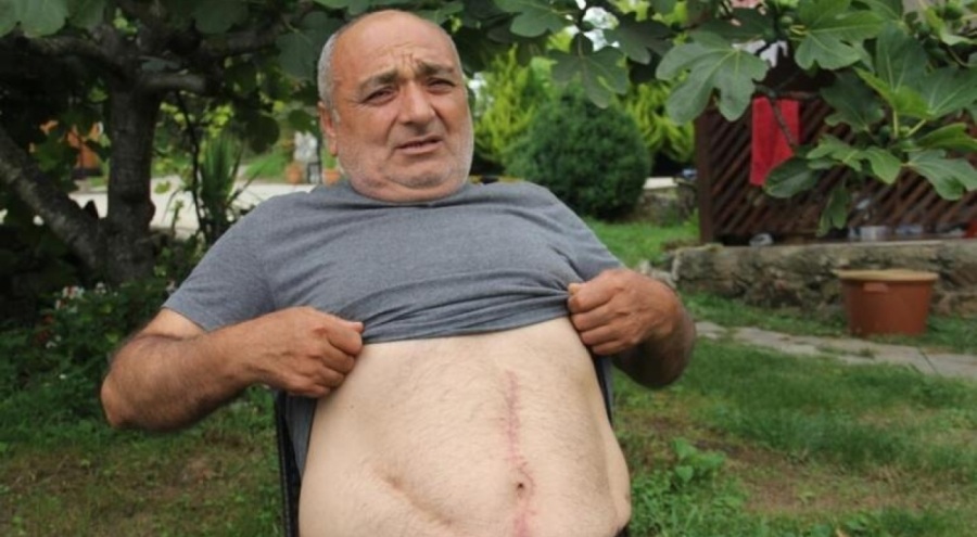 Ameliyatta karnında gazlı bez unutulduğunu 18 yıl sonra öğrendi, yüzde 73 engelli haline geldi