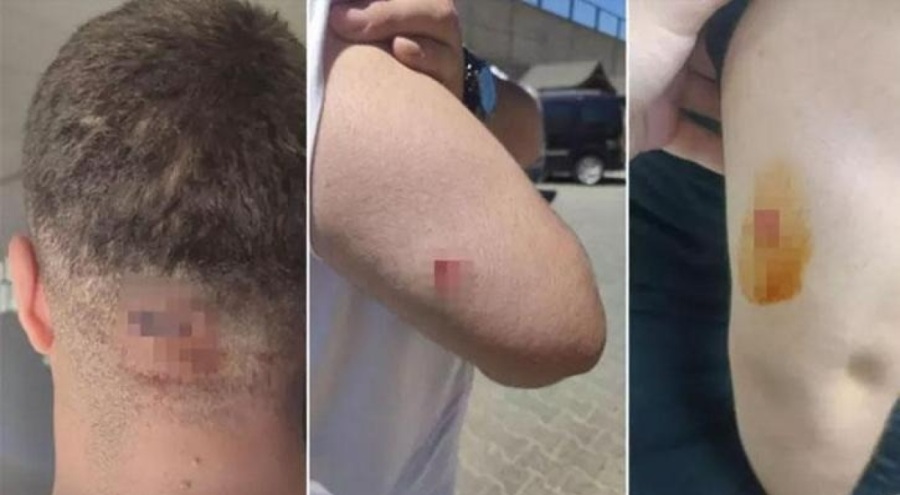 İnşaat mühendisleri denetim için gittikleri inşaatta dayak yedi