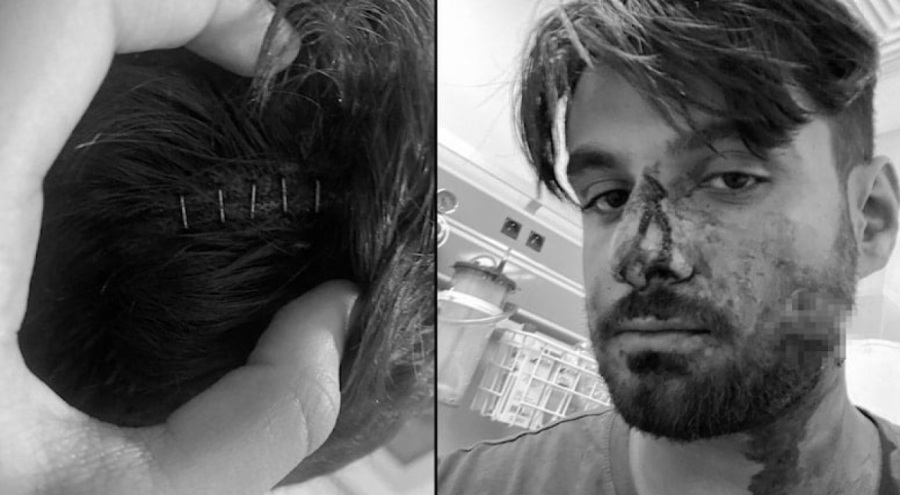 Üniversiteli Mustafa'yı Suriyeli sokak çetesi öldüresiye dövdü