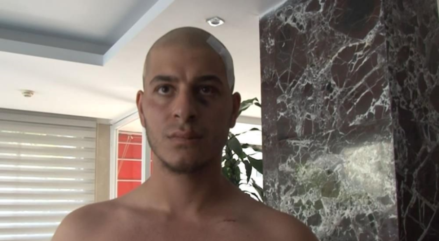 Alanya'da sopalı kavgada 'ahlaksız teklif' hakkında saldırıya uğrayan genç konuştu