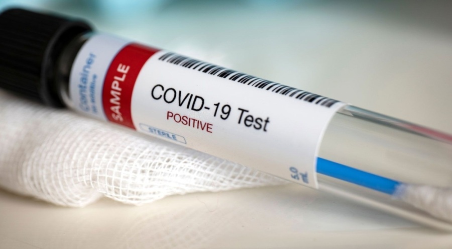 DSÖ duyurdu: Vaka ve ölümleri artırabilecek yeni Kovid-19 varyantı riski var