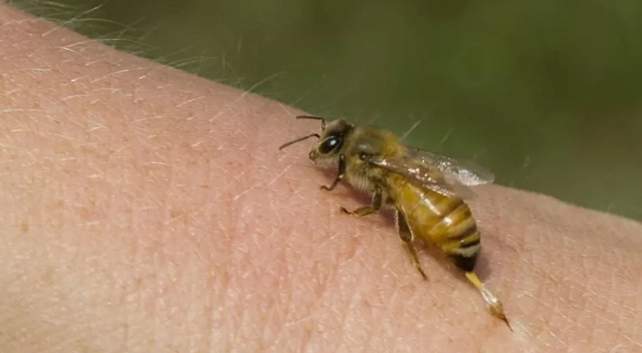 Arının soktuğu adam yaşamını yitirdi