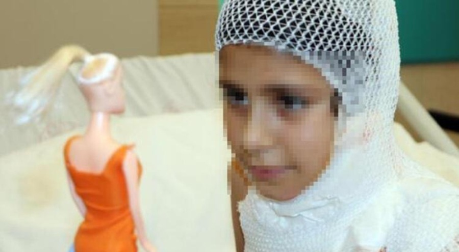 Sosyal medyada gördüğü kolonya yakma videosunu deneyince ölümden döndü