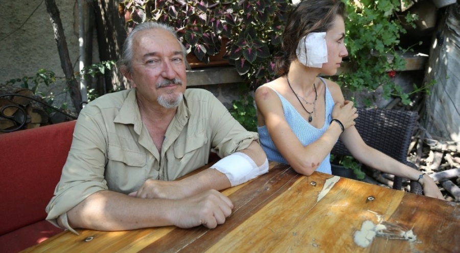 Nevşehir'de sahipsiz köpekler turistlere saldırdı