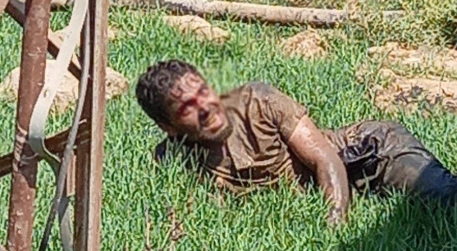 Şanlıurfa'da kuduz hastası adam hastaneden kaçtı: Vatandaşlar panik oldu