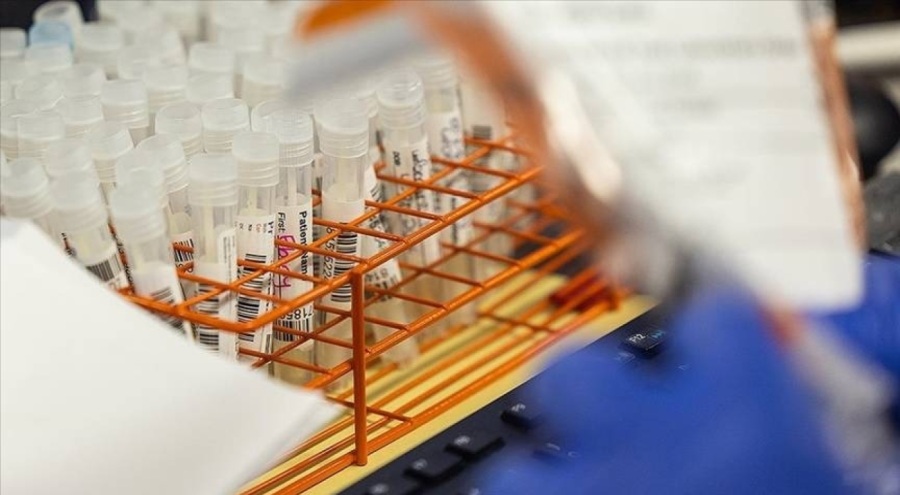 İngiltere'de Covid-19'un yeni varyantı "BA.2.86" ilk kez belirlendi!