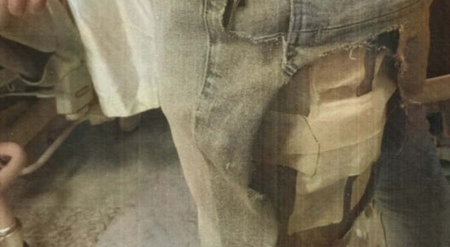 Sokak köpeklerinin saldırdığı avukat, belediyeye açtığı tazminatı kazandı