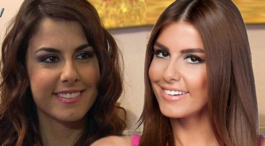 Oyuncu Tuğçe Özbudak kısmi felç geçirdi!