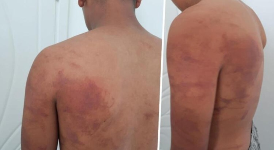 Baba ve amcadan 15 yaşındaki çocuğa ahırda işkence! Her satırı korkunç