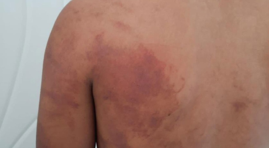 15 yaşındaki çocuğa babası ve amcasından ahırda zincirli işkence!