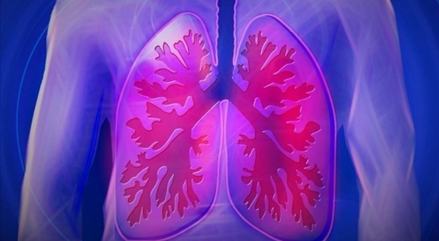 Polonya'da salgın alarmı! Ölü sayısı giderek artıyor