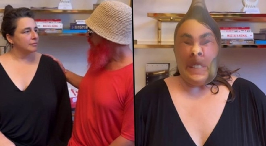 Oyuncu Esra Dermancıoğlu, estetik yaptıranlarla dalga çekti