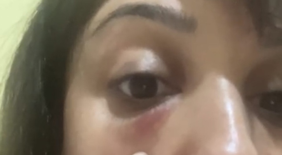 Hastanede doktor dehşeti! Kadının gözüne yumruk attı