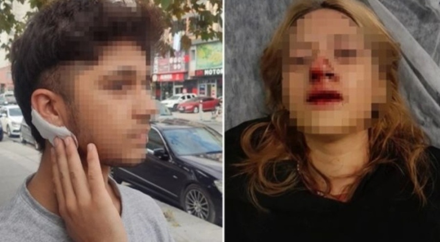 Genç kıza kaldırım taşıyla saldırmışlardı! Okul arkadaşı oldukları ortaya çıktı