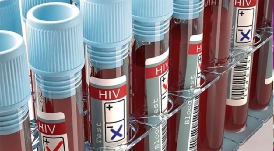 Yeni HIV aşısının denemelerine başlandı