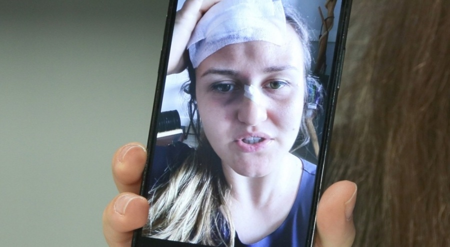 Göksel konserinde havai fişekler sebebiyle duyma yetisini yüzde 65 kaybetti