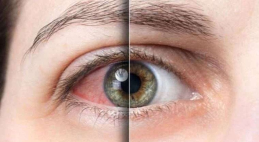 Uzmanı uyardı: Sonbaharda göz hastalıklarına dikkat!