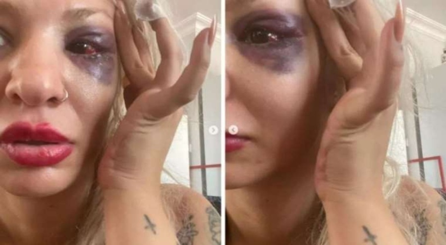 'Yüzyüzeyken Konuşuruz" üyesi sevgilisini darbetti iddiası!