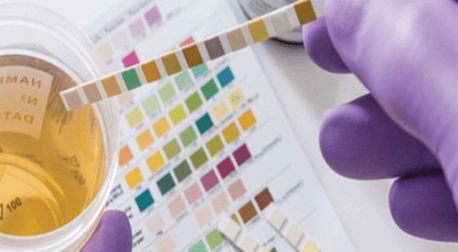 Uzmandan uyarı: İdrarda kan görmeyi hafife almayın