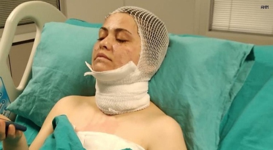 Yüzüne kimyasal madde fırlatan eski eşinden tekrar şikayetçi oldu!