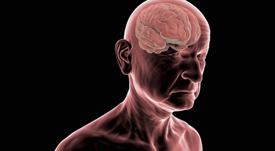 Uzmanlar açıkladı: Kafa vuruşu yapmak, futbolcularda alzheimer riskini 2 kat artırıyor