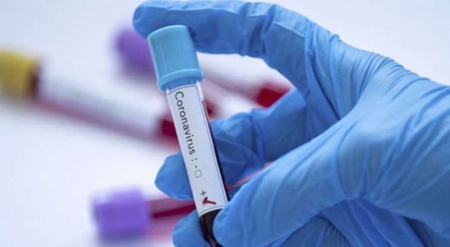 Bilim kurulu üyesinden uyarı: Kış döneminde yaygın ve baskın olacak!