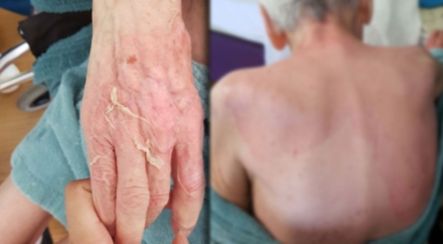 Adli tıp raporu gerçeği ortaya çıkardı! Yaşlı bakımevinde korkunç ölüm