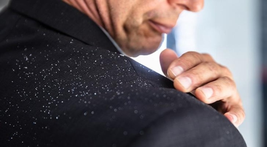 Saç kepeği olanlar dikkat! Hastalık habercisi olabilir