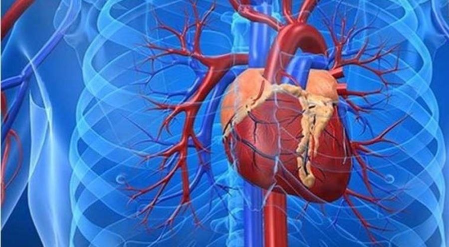 Vücuttaki tehlike: Aort damar yırtılması