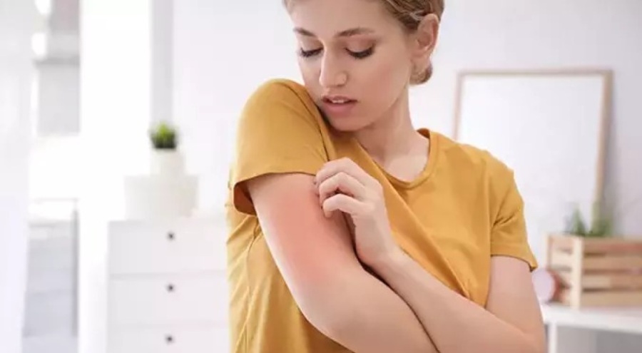 "Kliniklerdeki uyuz vakaları yüzde 25'e yükseldi"