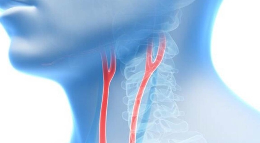 "Şah damarı tıkanması" nedir?