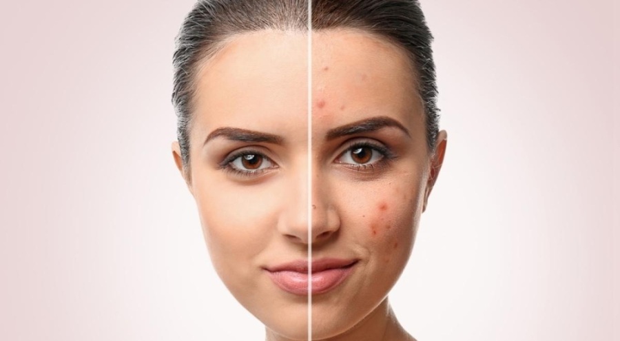 Yıllara meydan okuyan cilt rutini