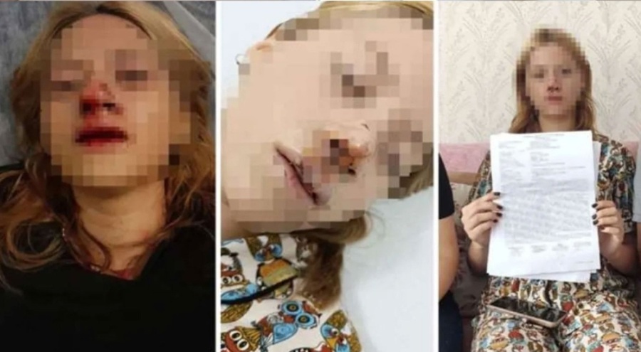 Liseli Mervenur'a kaldırım taşlı saldırıya tahliye!