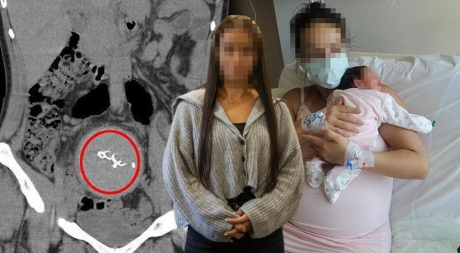 Doğumda vücudunda unutulan gazlı bez, 2 yıl sonra fark edildi