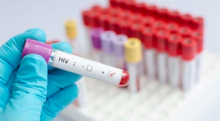 HIV oranı Türkiye'de artıyor