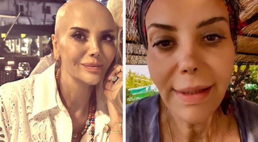 Kanserle mücadele eden Tanyeli'den ameliyat sonrası ilk açıklama geldi