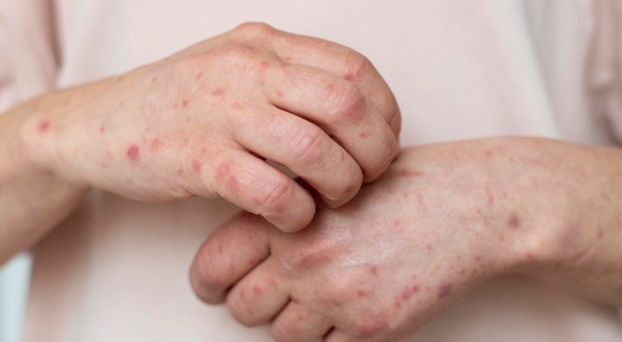 Profesörden önemli uyarı!  30 kat hızla yayılıyor...