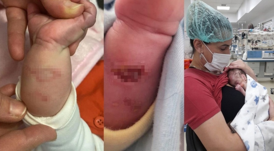 Hastanede skandal! Dördüz bebekler için "Yanarak öldüler" iddiası