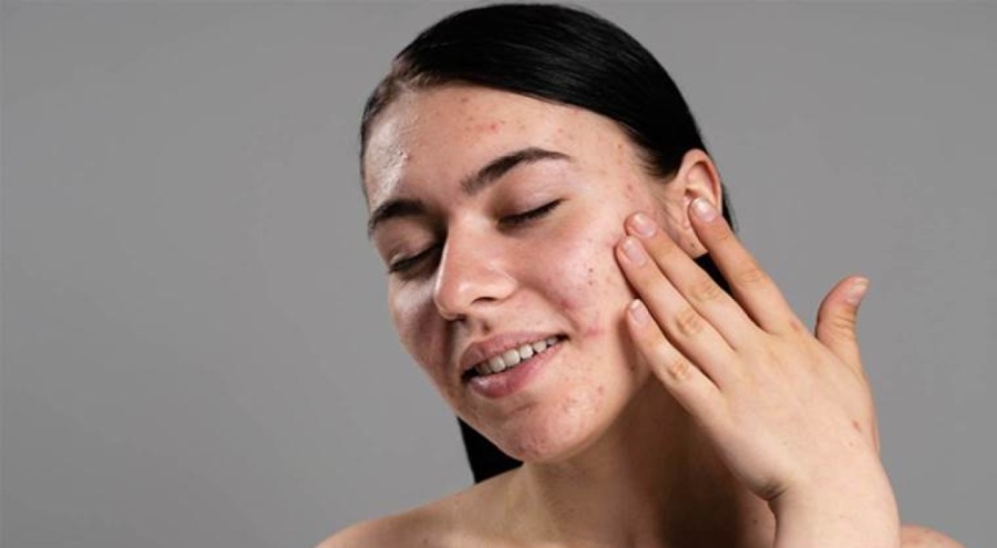 Kış aylarında cilt sağlığını korumak için bunları deneyin!