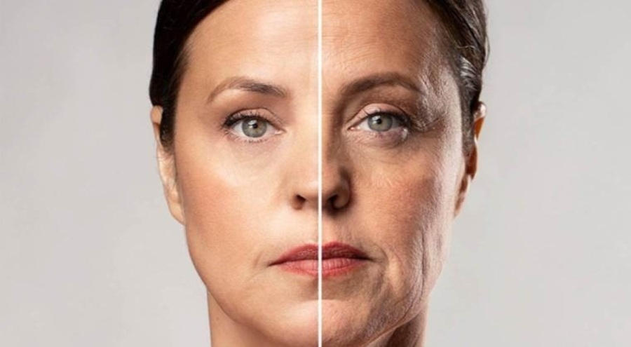 Diyetisyen açıkladı: Fazla şeker tüketimi cildi nasıl etkiler?