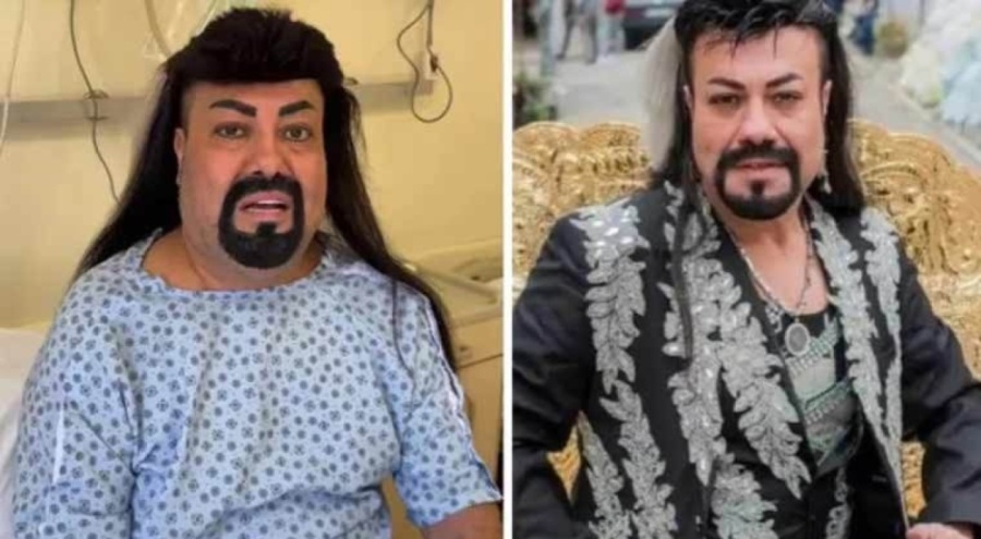 Kobra Murat'ın bağırsağı çatladı: 'Ölüm tehlikesi olan bir ameliyata giriyorum'