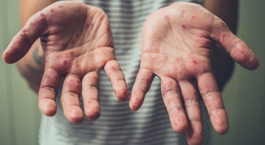 Uzmanlar büyük tehlikeye karşı uyardı!