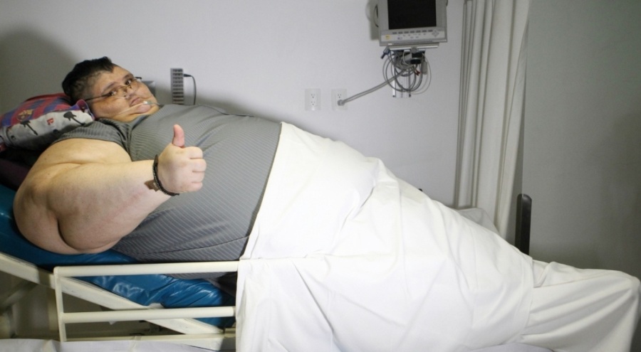 Obezite tedavisinde umut veren hap açıklandı