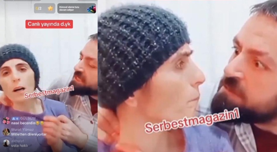 TikTok canlı yayınında şiddete uğradı! Kafa atarak kurtuldu Serbestmagazin1