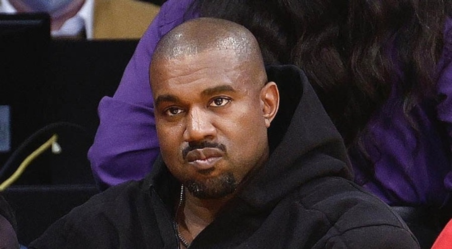 Kanye West tüm dişlerini söktürdü
